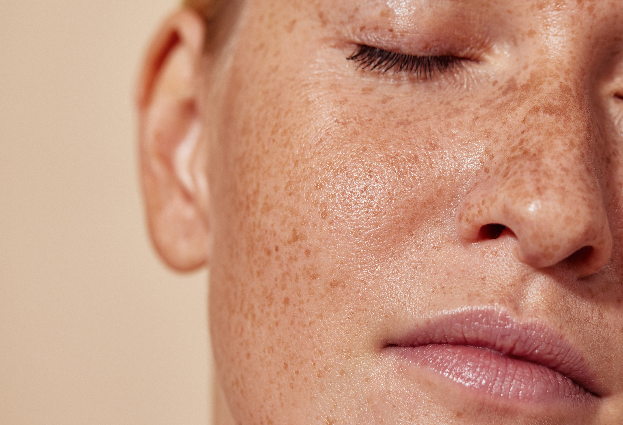 Certificate in Medical Skin Peels